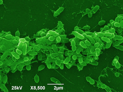 Bakterie - Problemy Spowodowane Biofilmem Bakteriologicznym w Sieciach Wodnych Zagrożenia dla Ludzi i Zwierząt